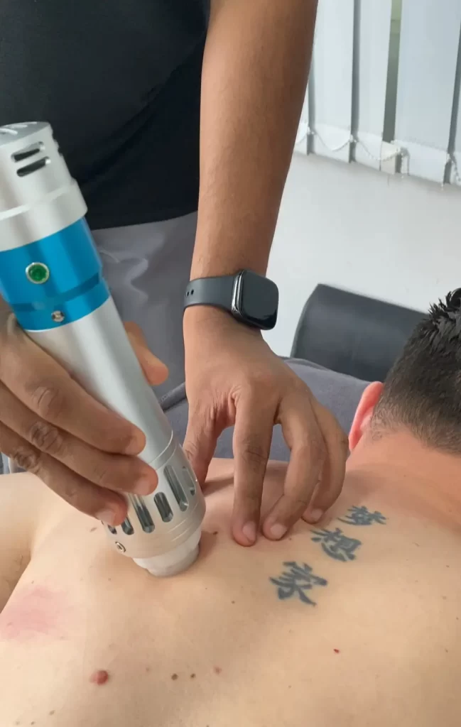 The Benefits of Shockwave Therapy